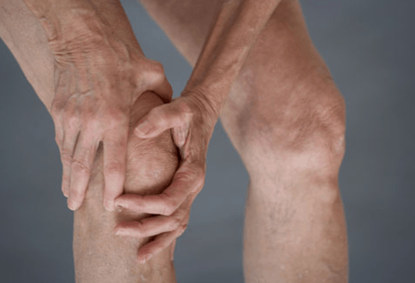 A Few Facts About Knee Osteoarthritis