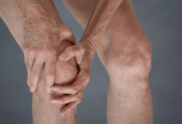 Osteoarthritis